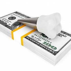 dental implant lying on top of a stack of money