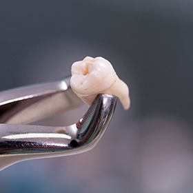 tooth on extraction tool