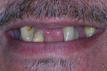 patient 2c before
