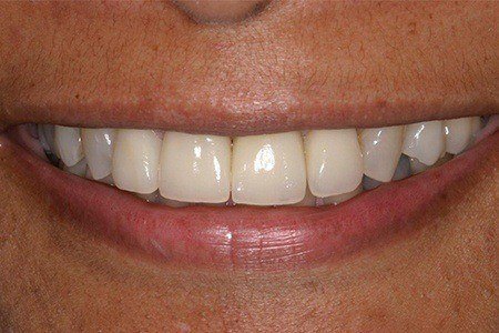 patient 10 after