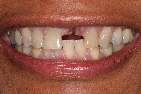 patient 10 before