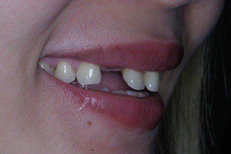 patient 3b before