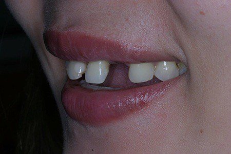 patient 3c before