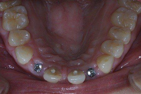 patient 3d before
