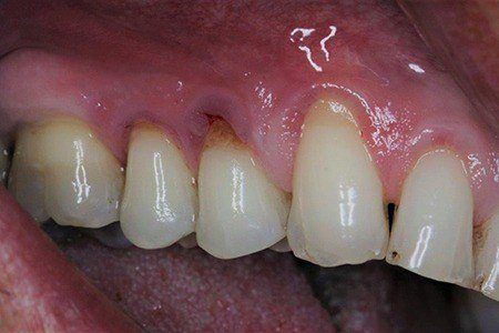 patient 5 before