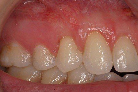 patient 6 after