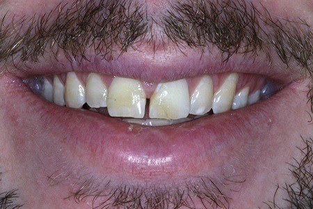 patient 1 before