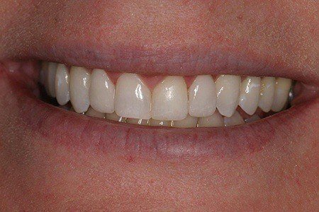 patient 7 after