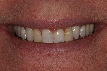 patient 7 before