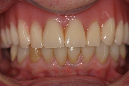 patient 8b after