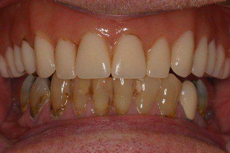 patient 8b before