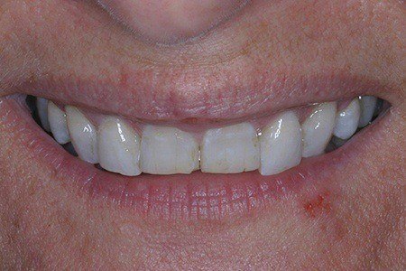 patient 9 before