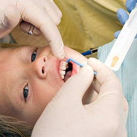 young child getting teeth cleaning