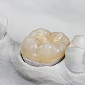 porcelain crowns