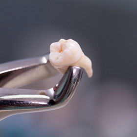 a close-up of a tooth that’s been extracted