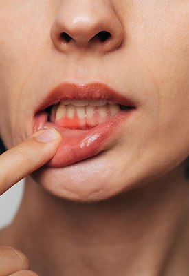 Treat gum disease near Allendale