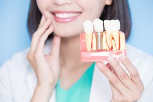 Smiling woman holds model of dental implants in Lawrenceville