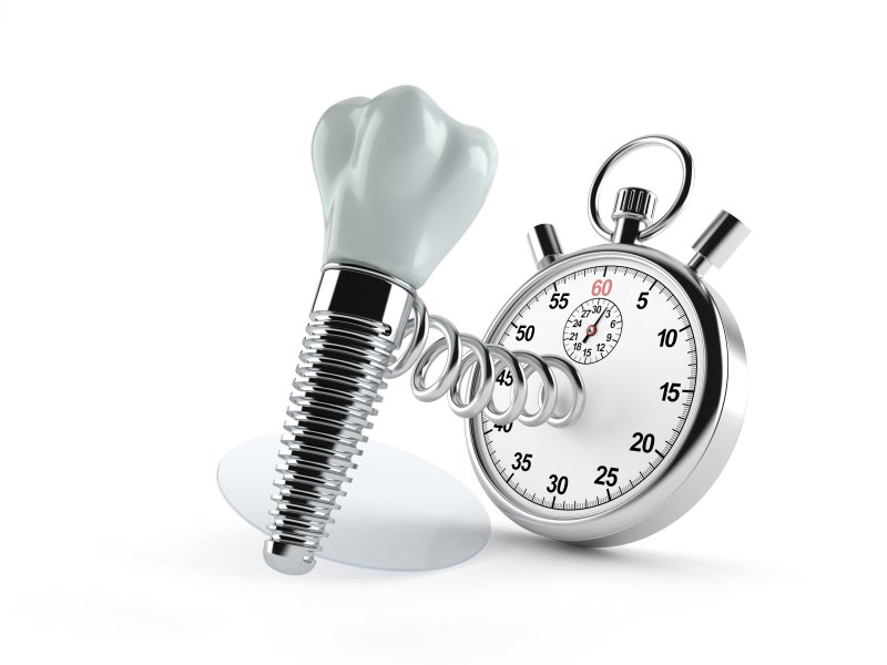 Dental implant with a clock springing out of it