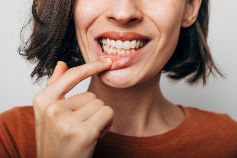 A closeup shot of a woman’s gum disease