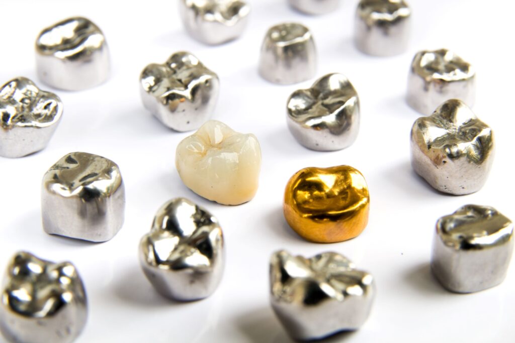 A tooth-colored dental crown in the midst of several metallic ones