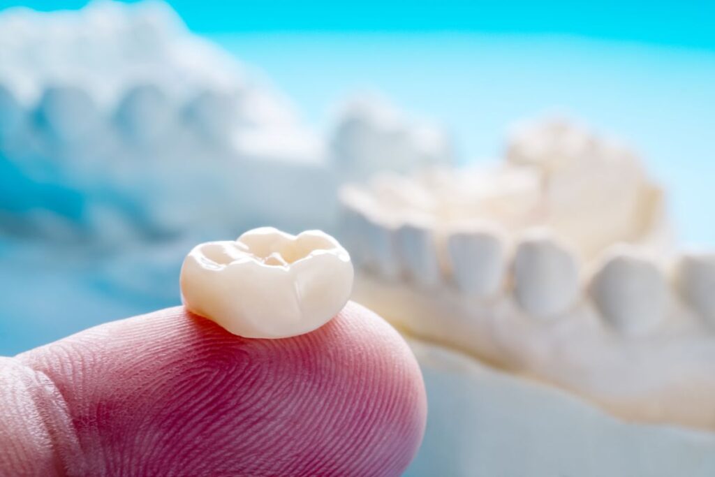 A dental crown sitting on a fingertip
